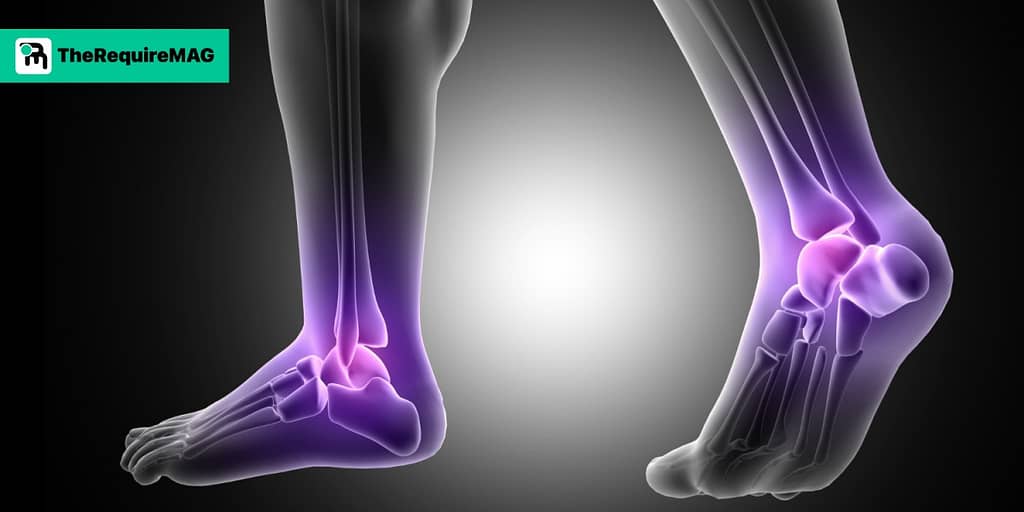 how to relieve foot pain - therequiremag